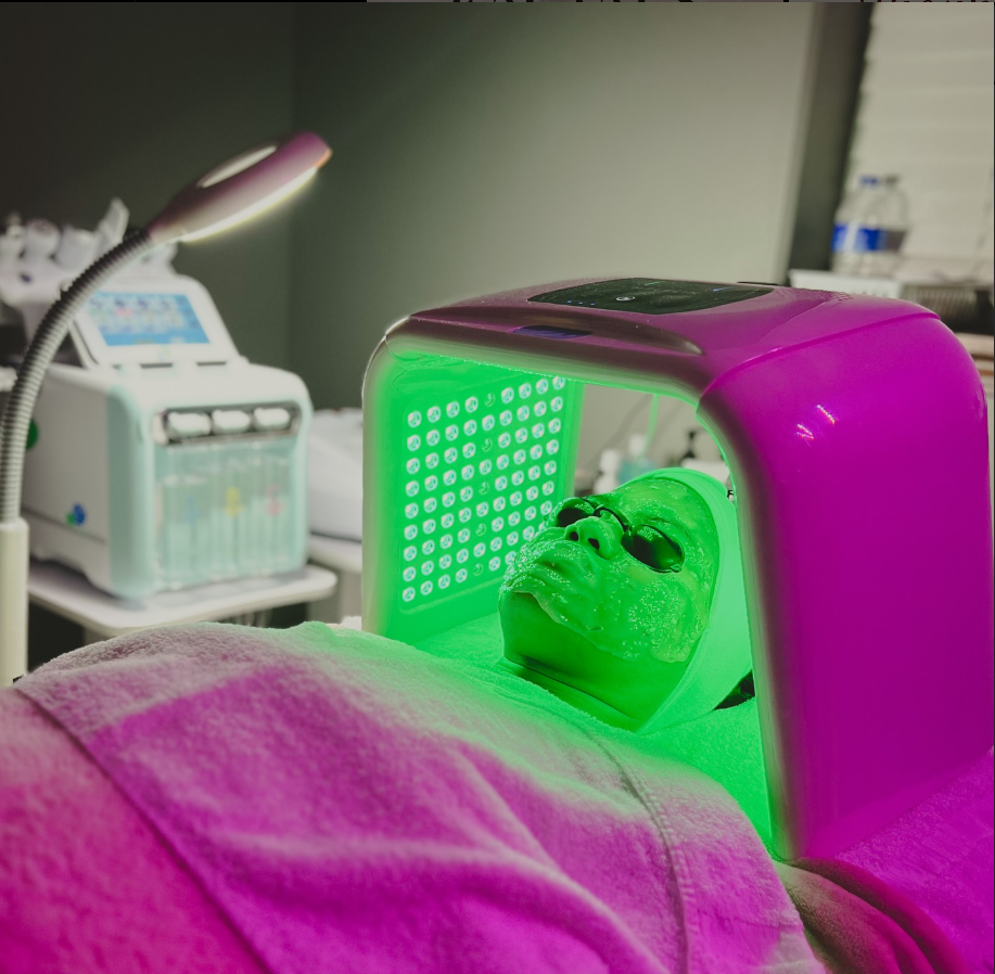 Chemical Peel Image